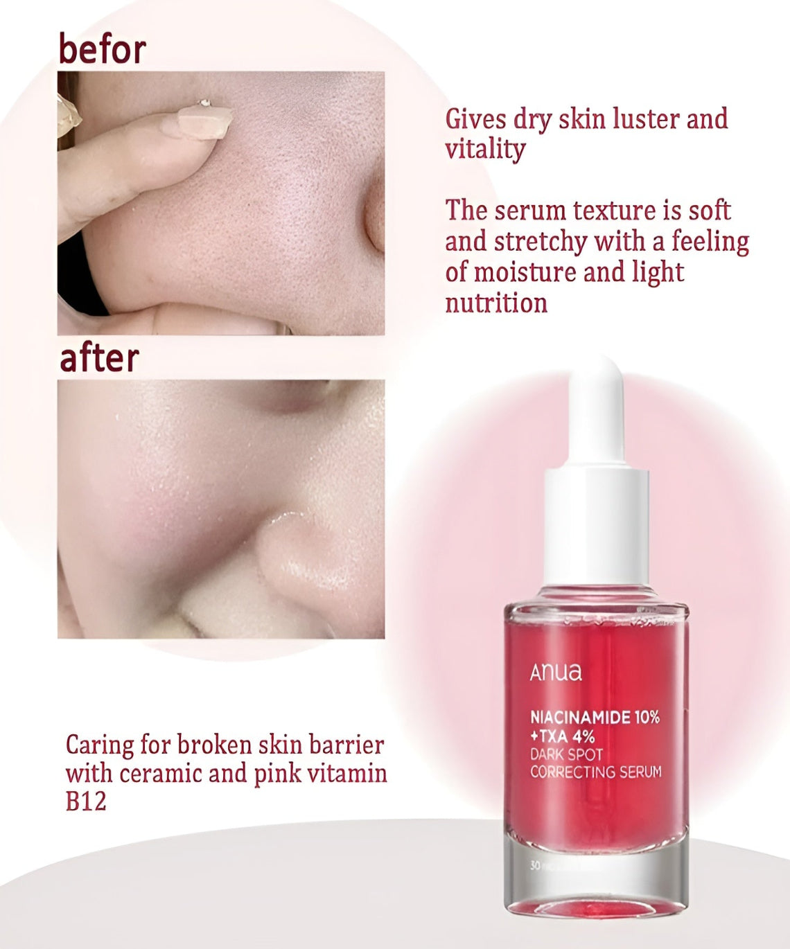 سيروم Anua Niacinamide 10 TXA 4 الوردي الأصلي - أفضل سيروم لعلاج البقع الداكنة وآثار الحبوب - منتج K-Beauty في مصر
